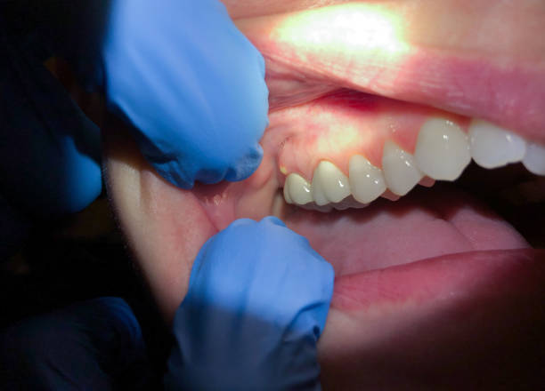 Best Emergency Dentist for Knocked-Out Tooth in Sutter, CA