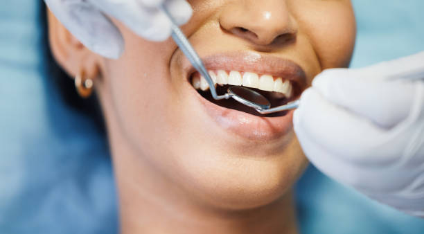 Best Emergency Root Canal Treatment in Sutter, CA