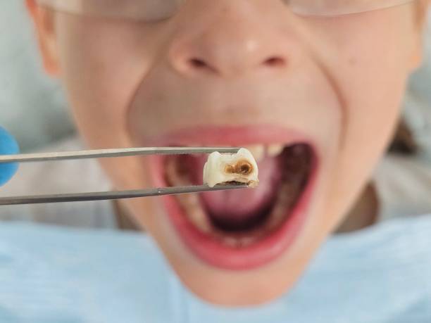 Best Pediatric Emergency Dentist in Sutter, CA